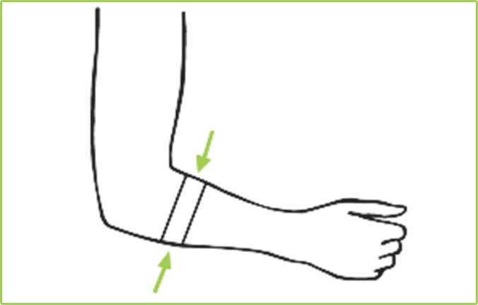 آرنج تنیس بازان نئوپرنی CURED