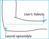 آویز دست شانه ای(با ترمز شست) Cured