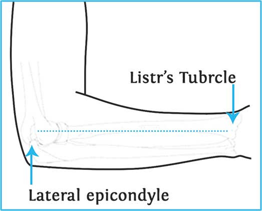 آویز دست شانه ای(با ترمز شست) Cured