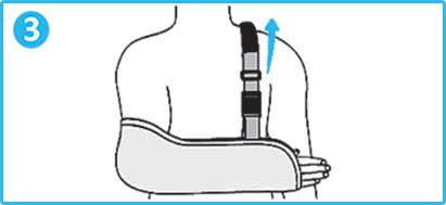آویز دست شانه ای(با ترمز شست) Cured