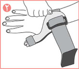 تثبیت کننده شست نئوپرنی CURED