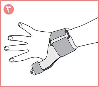 تثبیت کننده شست نئوپرنی CURED