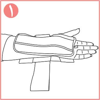 تثبیت کننده مچ دست اکستریم نئوپرنی CURED