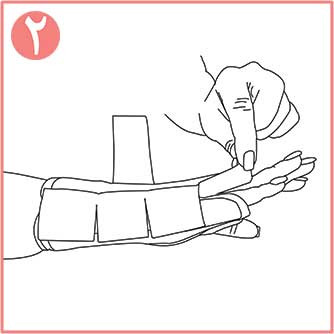 تثبیت کننده مچ دست اکستریم نئوپرنی CURED