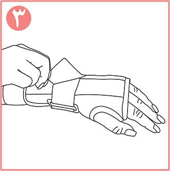 تثبیت کننده مچ دست نئوپرنی CURED