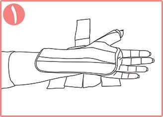 تثبیت کننده مچ و شست دست اکستریم نئوپرنی CURED