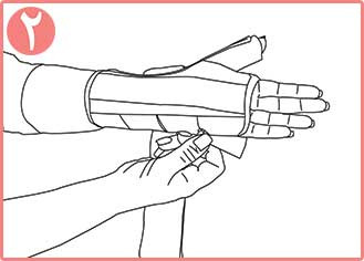 تثبیت کننده مچ و شست دست اکستریم نئوپرنی CURED