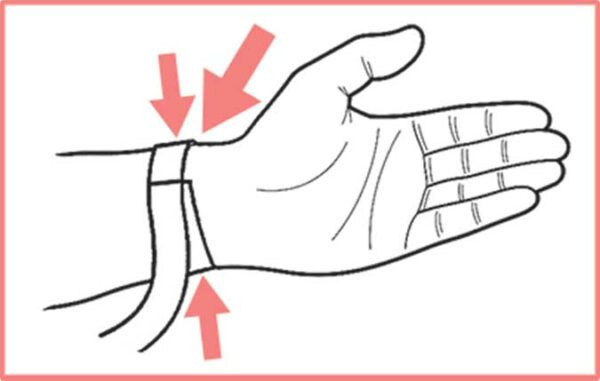 تثبیت کننده مچ و شست دست اکستریم نئوپرنی CURED