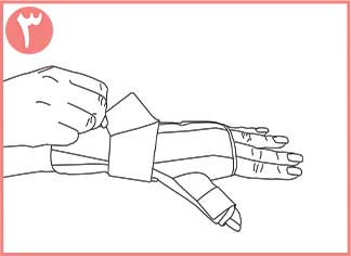 تثبیت کننده مچ و شست دست نئوپرنی CURED