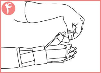 تثبیت کننده مچ و شست دست نئوپرنی CURED