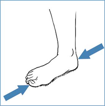 کفش زیر گچ CURED